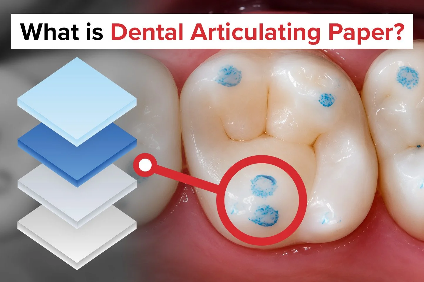 What Is Dental Articulating Paper and How Is It Manufactured?
