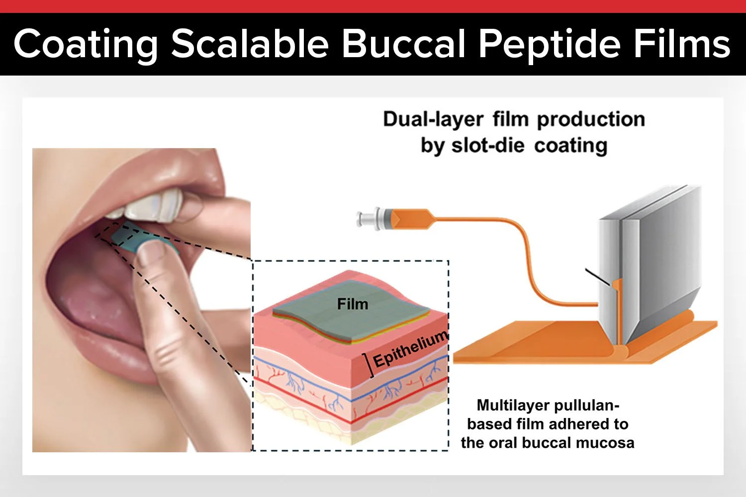 Novo Nordisk and Technical University of Denmark Advance Buccal Delivery of GLP-1 Peptides Using Slot-die Coating