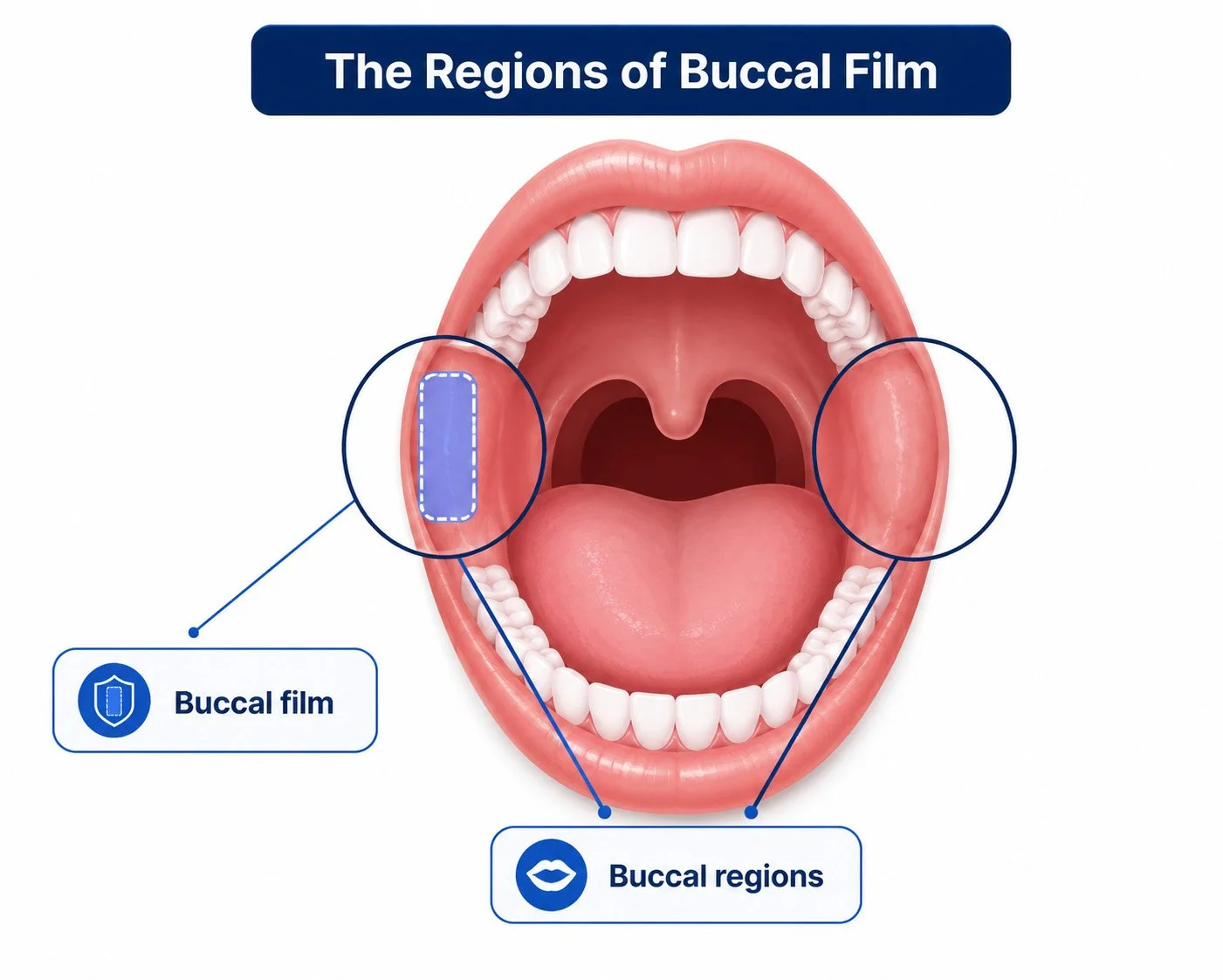 Key Properties of High-Performance Buccal Films