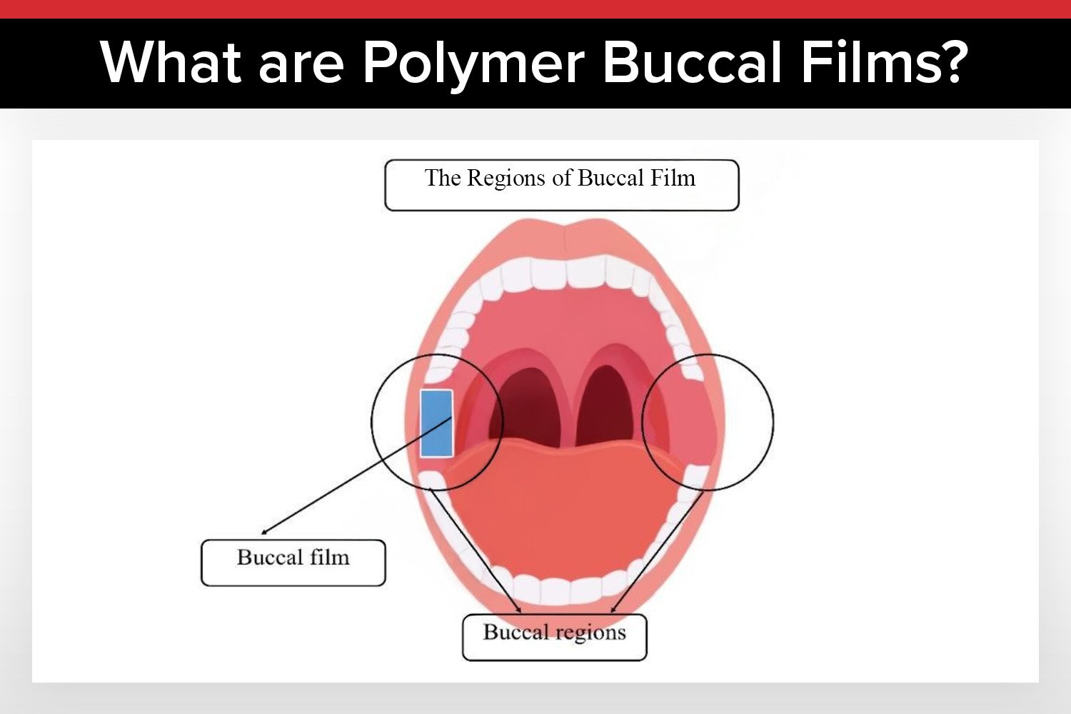 How Polymer Buccal Films Improve Drug Delivery for Patients