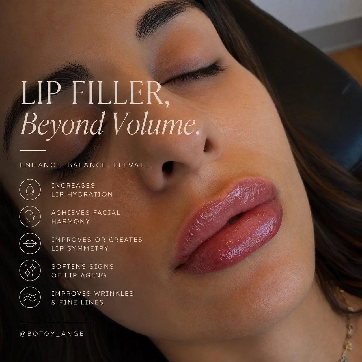 Lip filler isn&rsquo;t just about volume.

When thoughtfully placed, filler can enhance hydration, improve symmetry, soften fine lines and bring the lips into better proportion with the rest of the face.

The goal isn&rsquo;t simply bigger lips &mdas