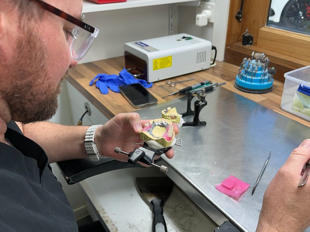 What You Need To Know About Denture Relines And Repairs?