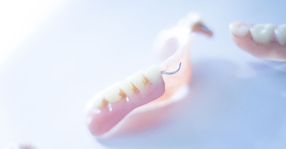 Partial Dentures in Brisbane: What They Are, How They Work, and Who They Suit