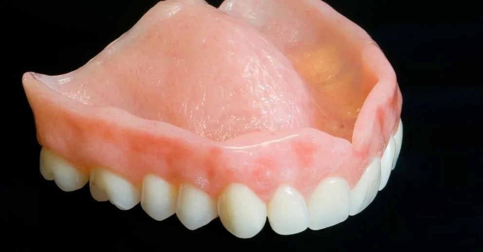 Denture Allergies: Can Materials Cause Reactions and What Are Your Options?