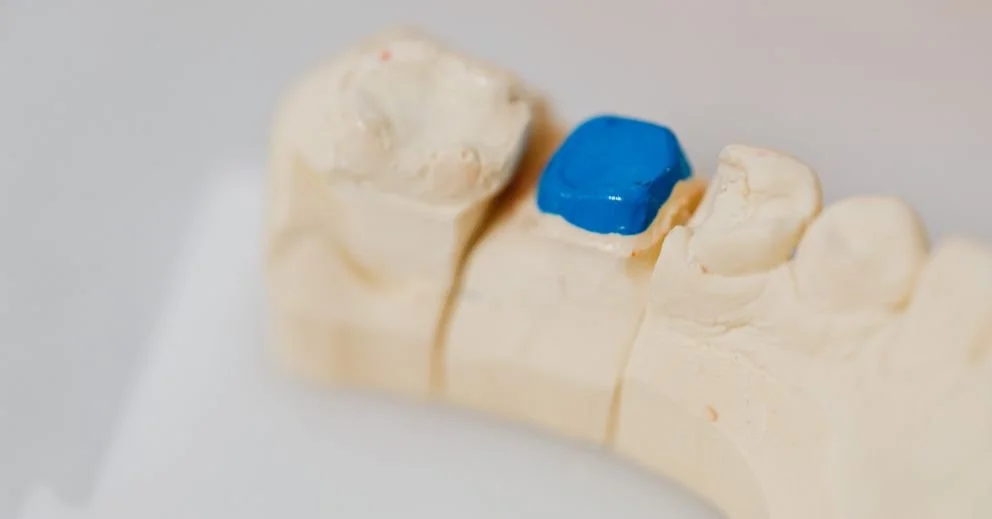 Can Implant Dentures Improve Your Chewing Strength?