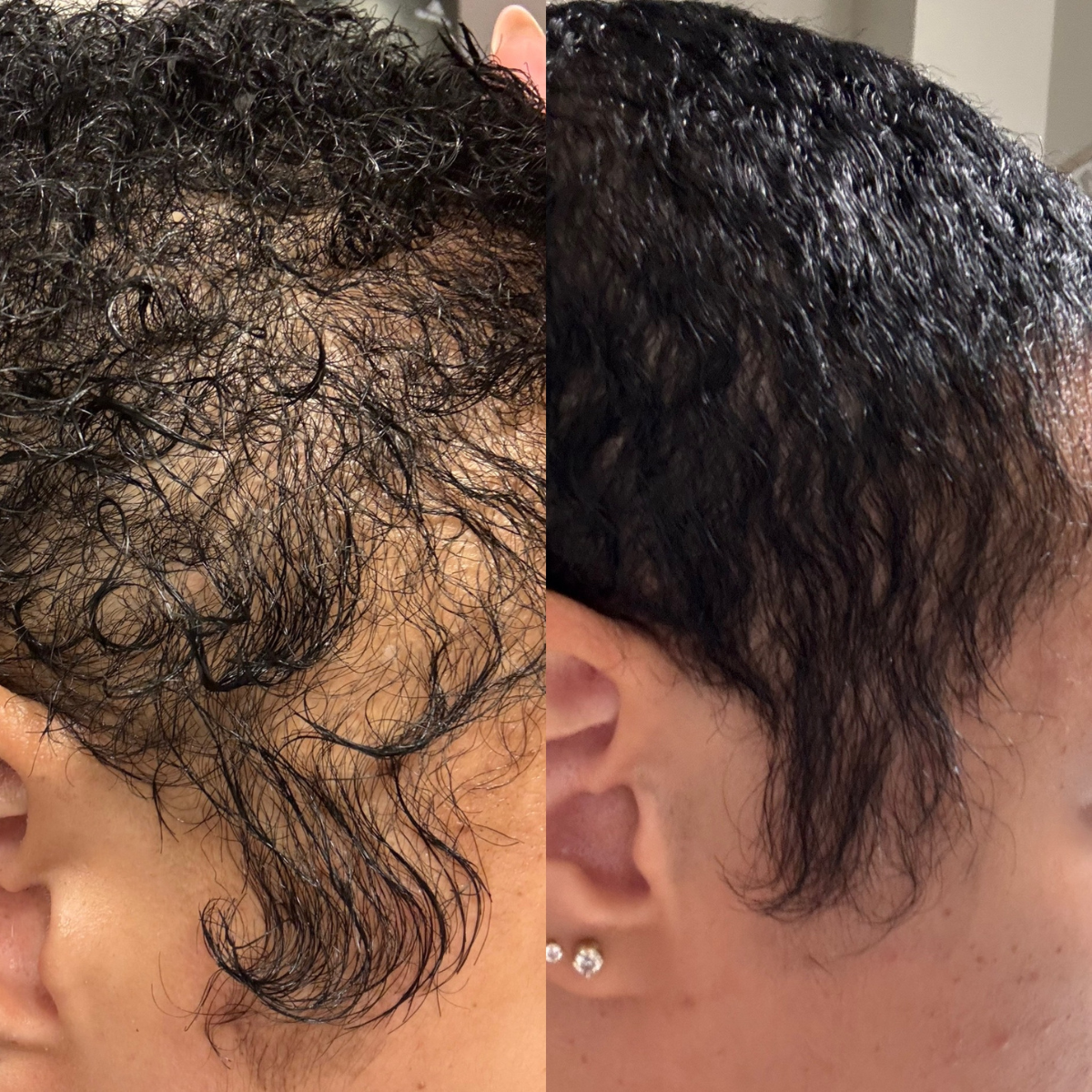 Comparison of a person's curly hair before and after a hair treatment, showing improvement in texture and curl definition.