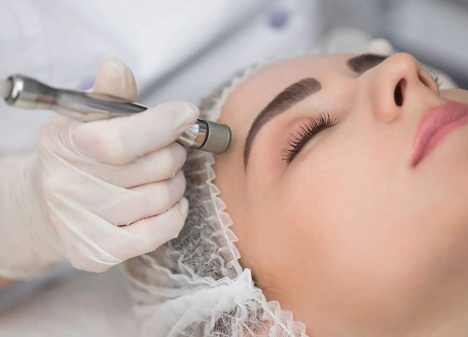 Houston Microneedling: Get Glowing Skin Without Surgery