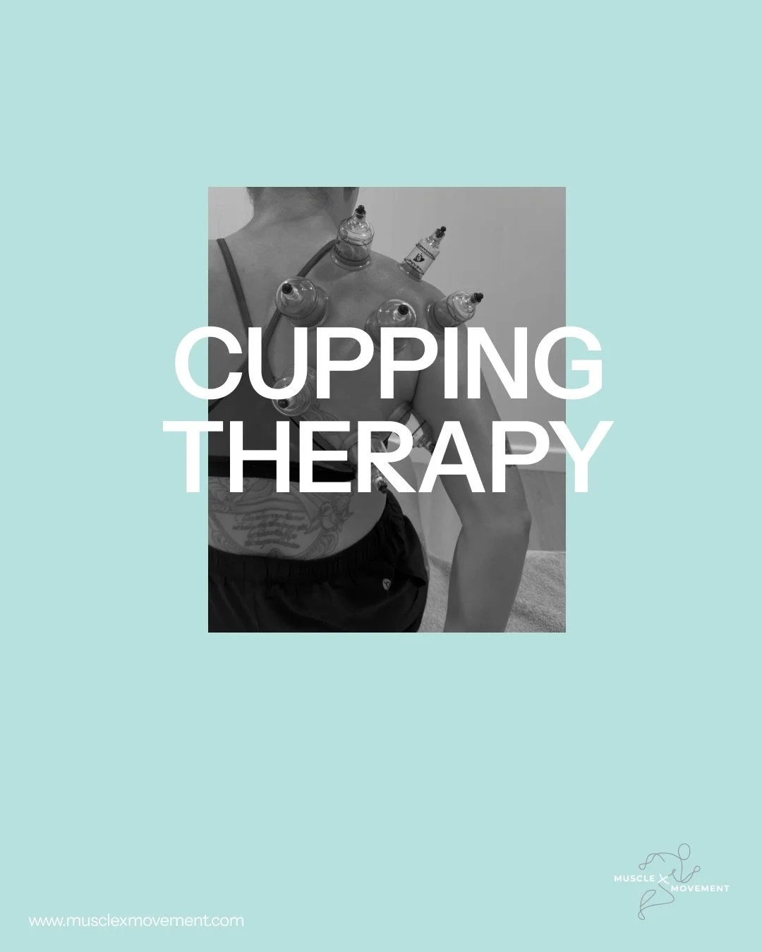 Gliding cups = next level relief 😌✨

Dynamic cupping isn&rsquo;t just about those cool little circles &mdash; it&rsquo;s all about movement. By gliding the cups across the muscles, we boost circulation, break up stubborn fascia, reduce inflammation,