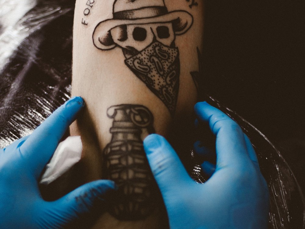 laser tattoo removal — Blog 2 — Edit Skin Clinic laser tattoo removal — Blog 2 — Edit Skin Clinic