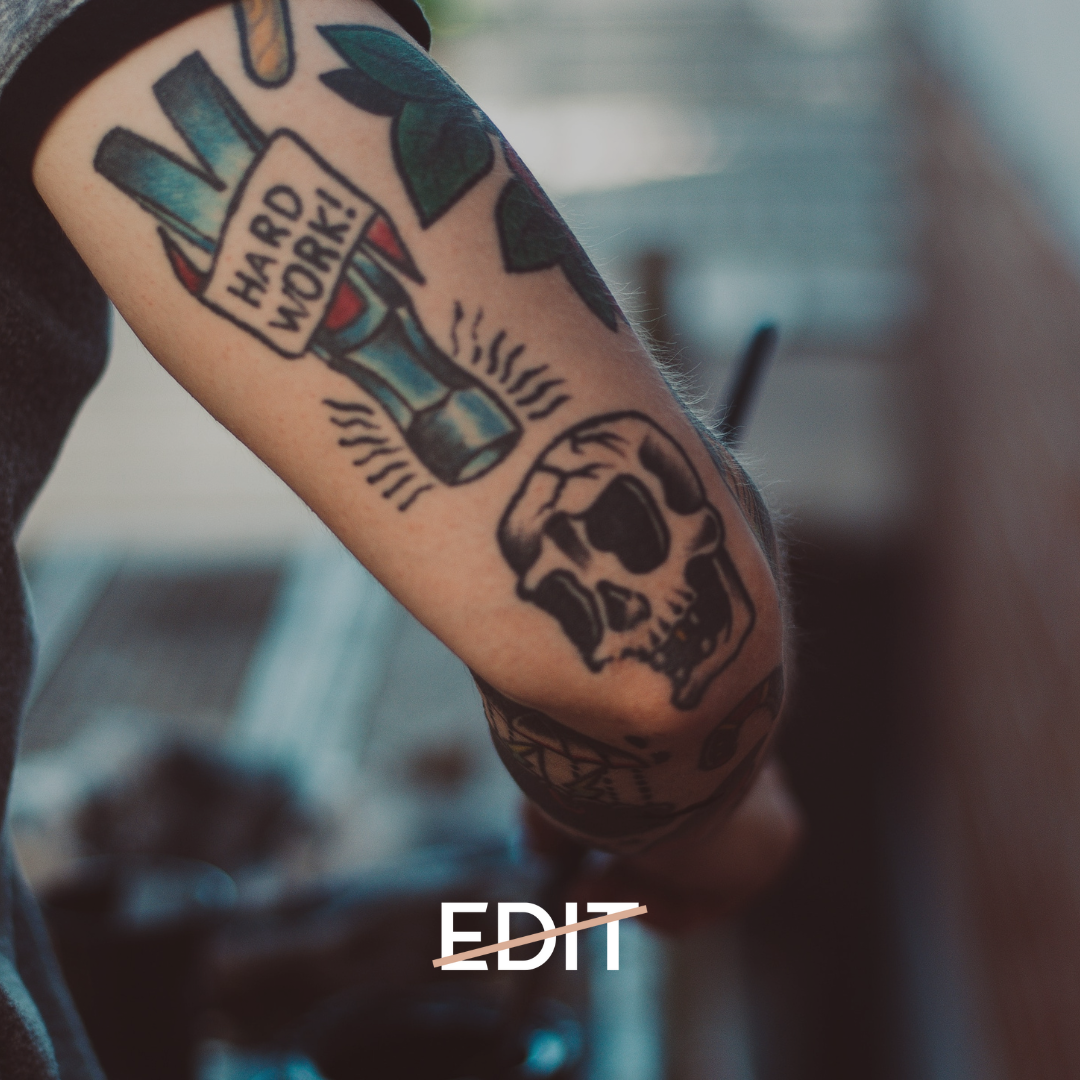 Laser Tattoo removal scar issues Dublin — Edit Skin Clinic