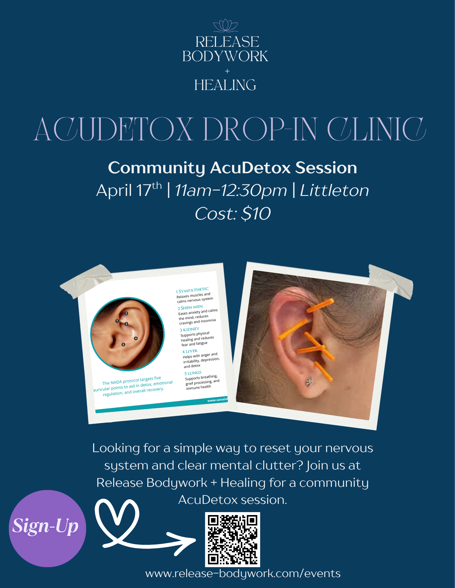 Midday Reset: AcuDetox Drop-In Clinic