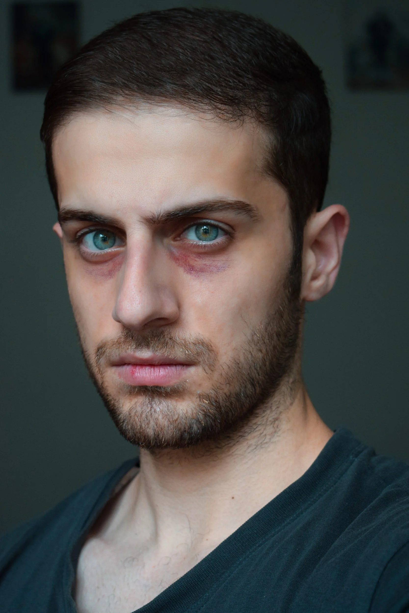 New Jersey State Prison Inmates Have no State Remedy in New Jersey for State Tort Claims for Personal Injuries Caused by Other Inmate Assaults