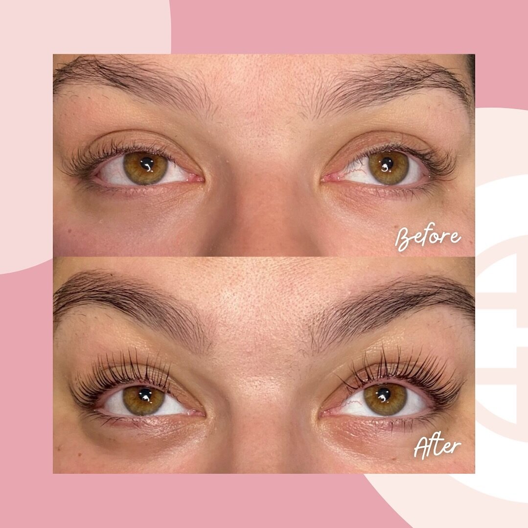 The secret to stunning natural lashes that keep on giving &ndash; Latisse + Lash Lift &amp; Tint Combo🌟✨ 

Not only does Latisse promote healthy lash growth, but it also offers long-lasting and incredible results. With our lash lift, we use a specia