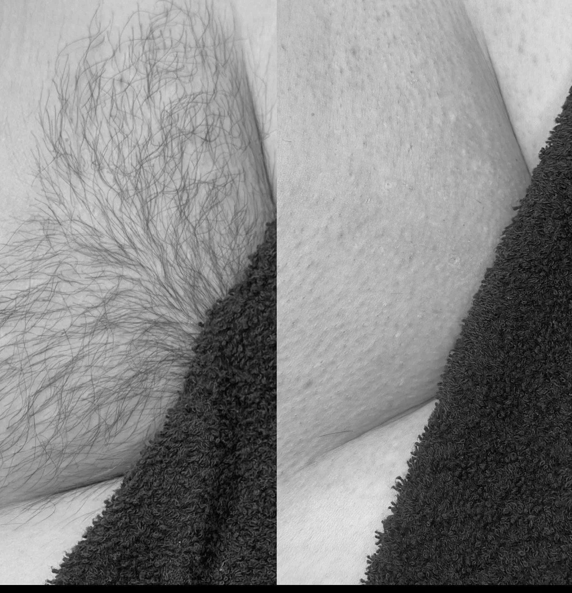 wax before and after