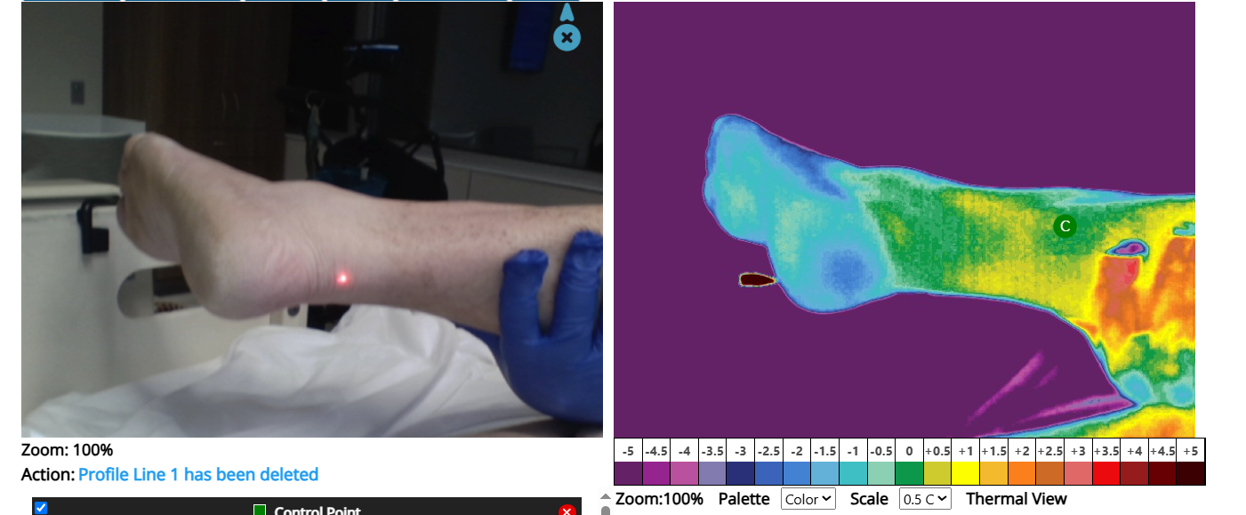 Innovation in Prevention: Siskin Hospital Uses Thermal Imaging to Improve Patient Care