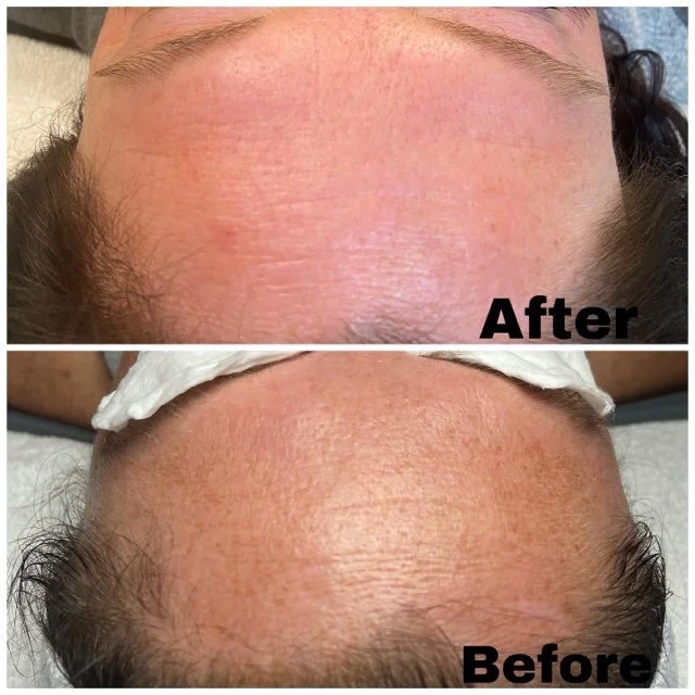 Facial Treatment