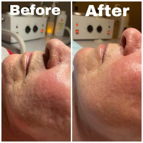 Facial Treatment