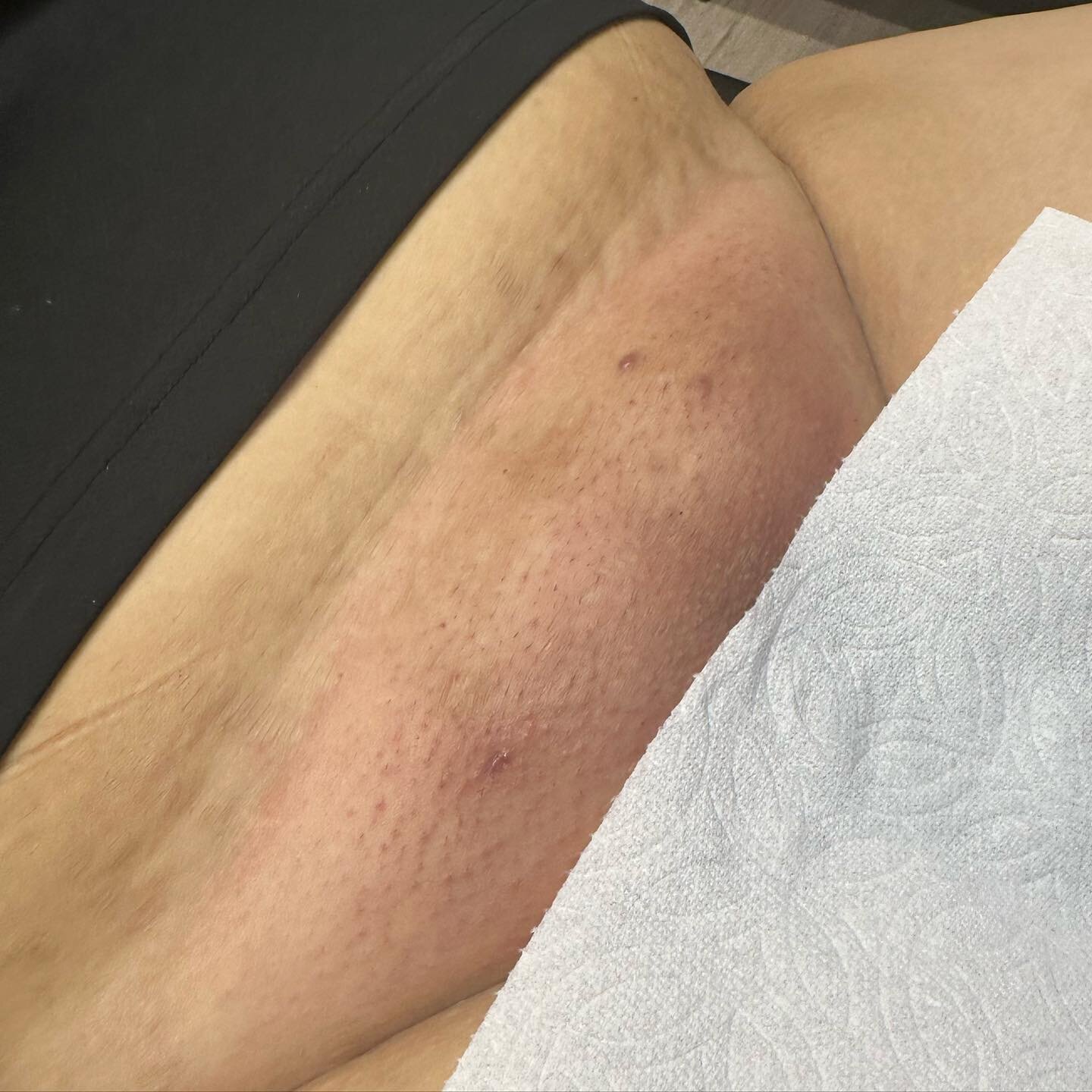 Sorry NOT Sorry that your IG feed keeps getting blasted with VAGS&rsquo;! 😝
I can&rsquo;t help share the awesome results!!!

#sanantoniowaxer #waxer #wax #brazilianwaxing #esthetician #cosmetology #wax #waxsuite