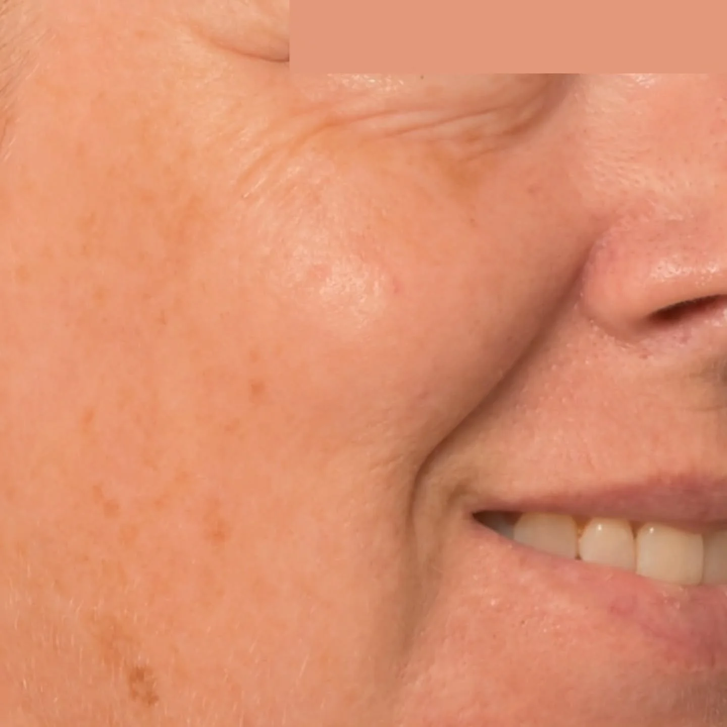 If you've been in my chair you've heard me talk about skin quality, and it's relationship to lines and wrinkles. 

I often compare the skin to different grades of paper. A thin crepe paper creases easily. A thicker card stock paper is resistant to cr