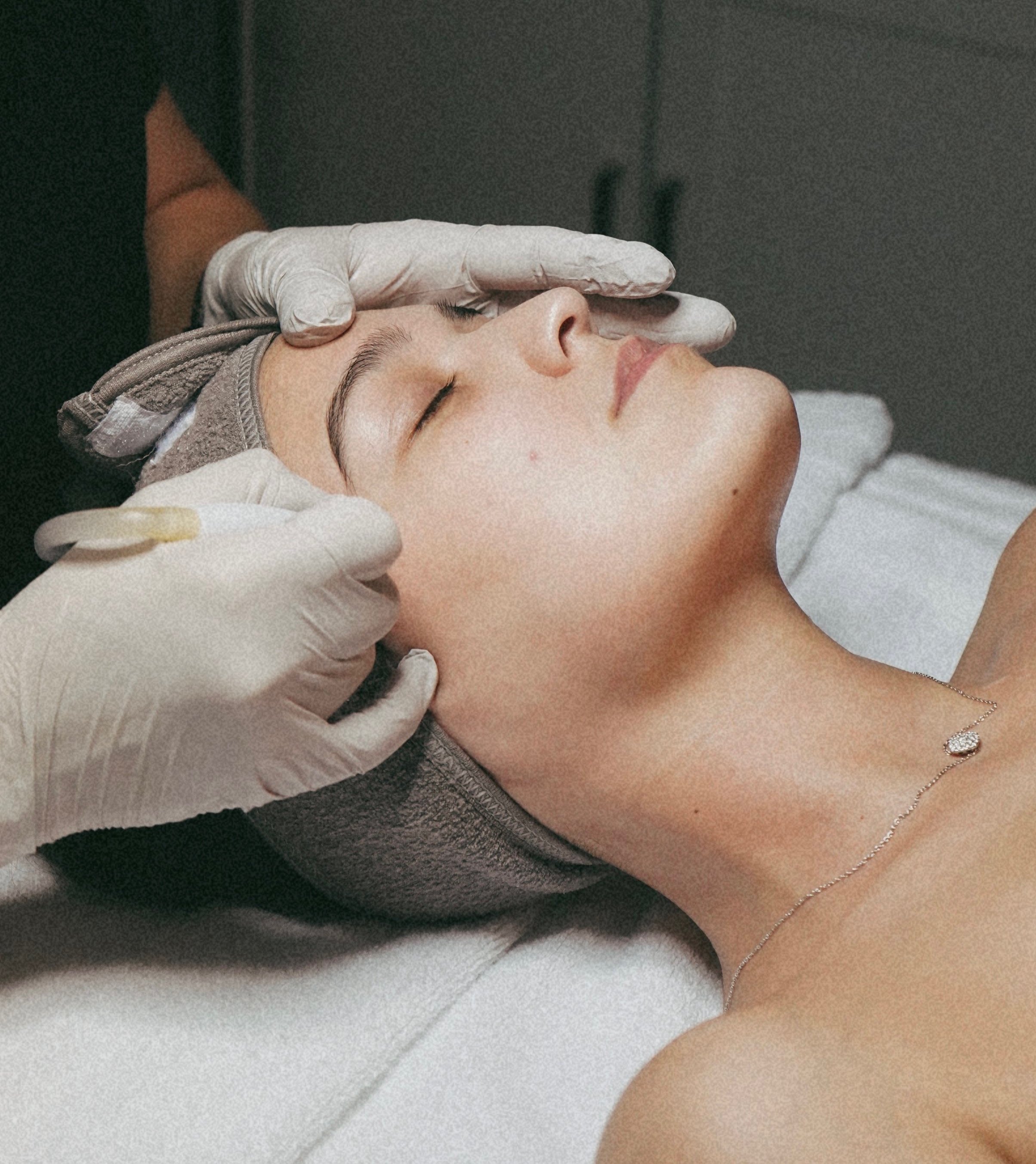Microdermabrasion