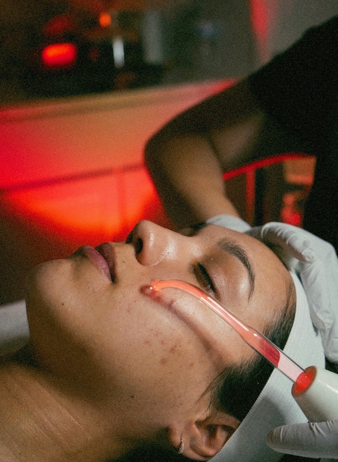Anti-Acne Facial