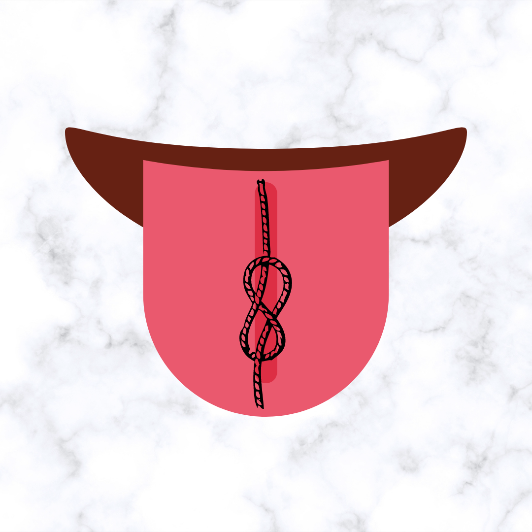 Tongue tie feeding support