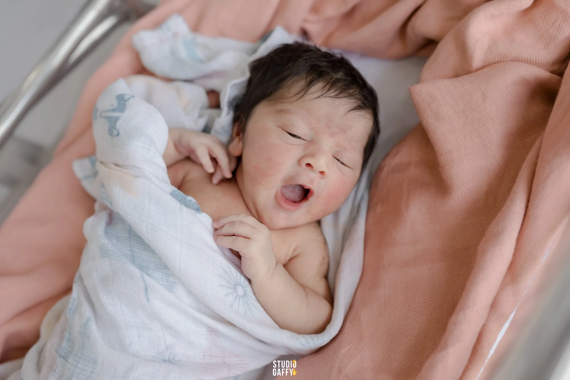 A newborn baby with dark hair yawning while lying on an adult's chest, wrapped in a white hospital blanket.