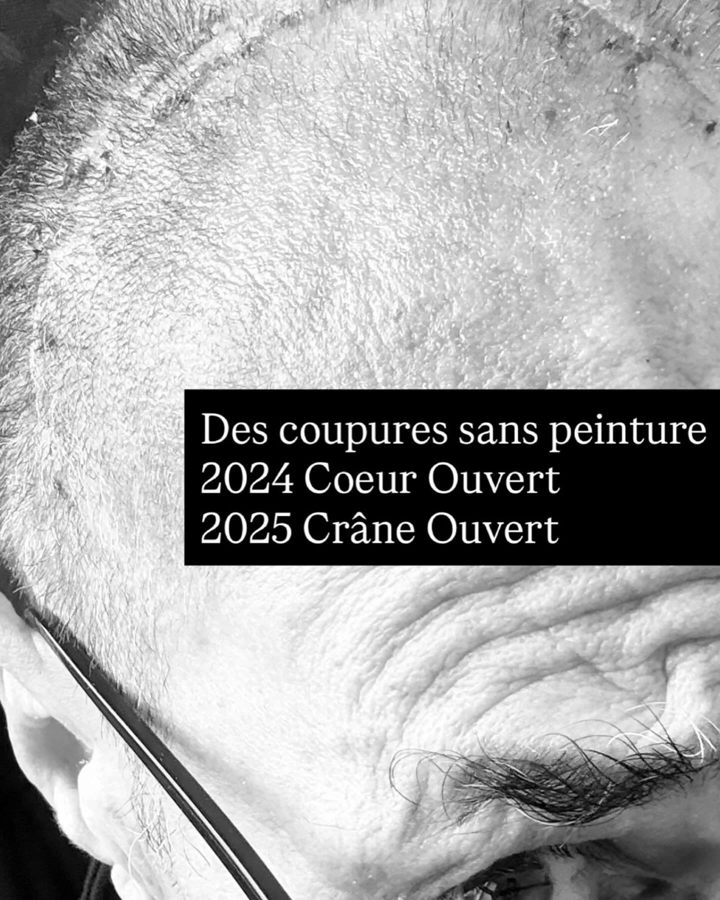 I&rsquo;m gradually trying to get my head together. It&rsquo;s tough. 
Je tente de rassembler les morceaux. C&rsquo;est dur.