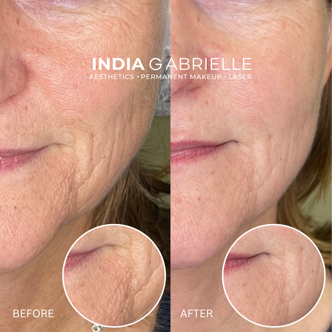 social post - 2024-03-12T100456.566.png