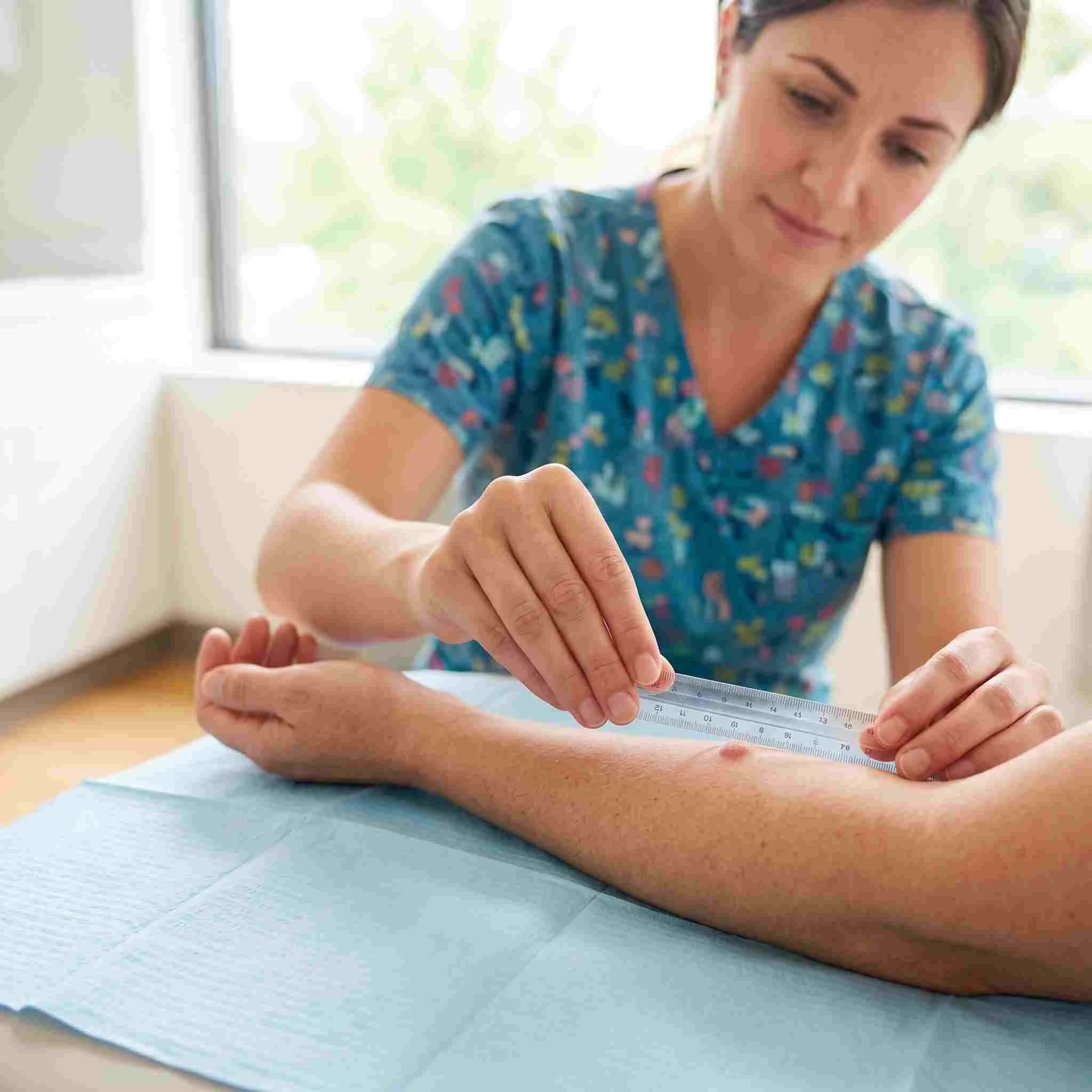 The Two-Step TB Test: How to Read a PPD and Why It Is Done Twice