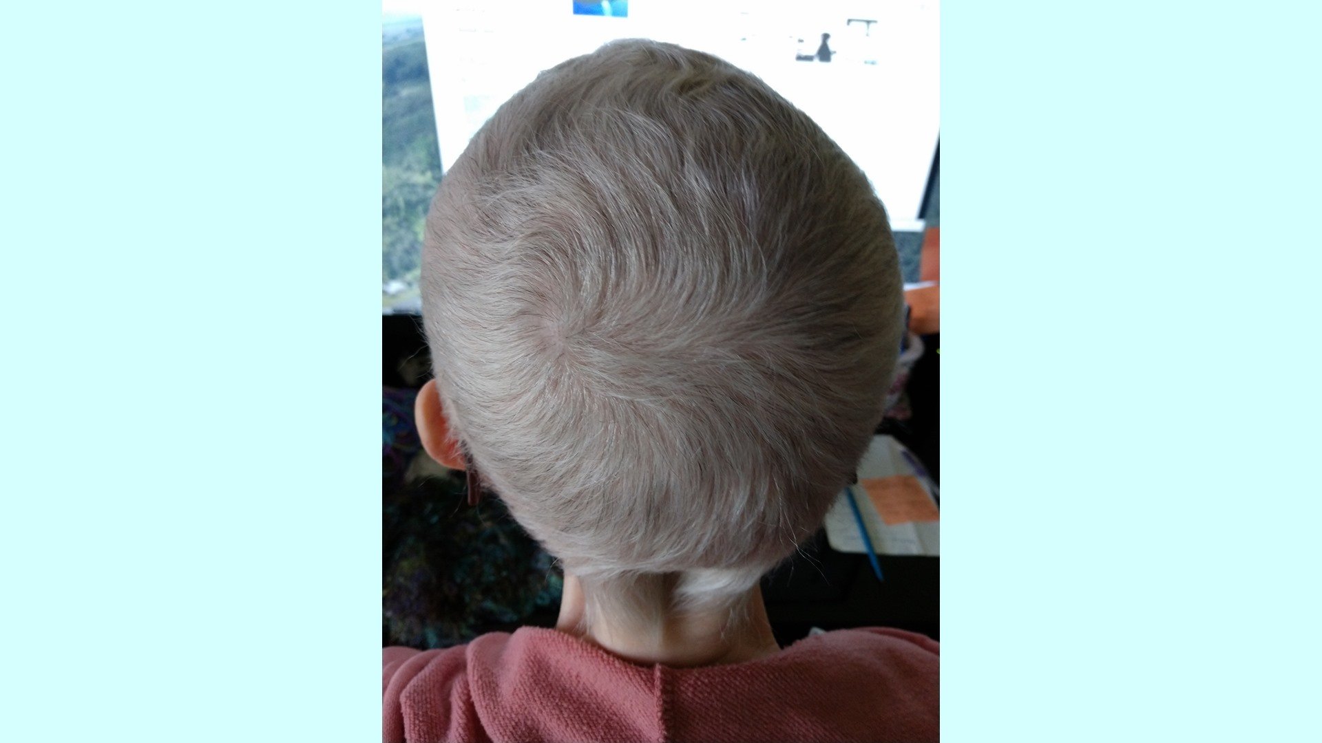 Hair regrowing after chemo