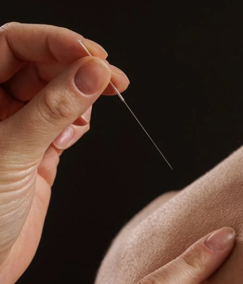 Gunn IMS and dry needling physiotherapy treatment