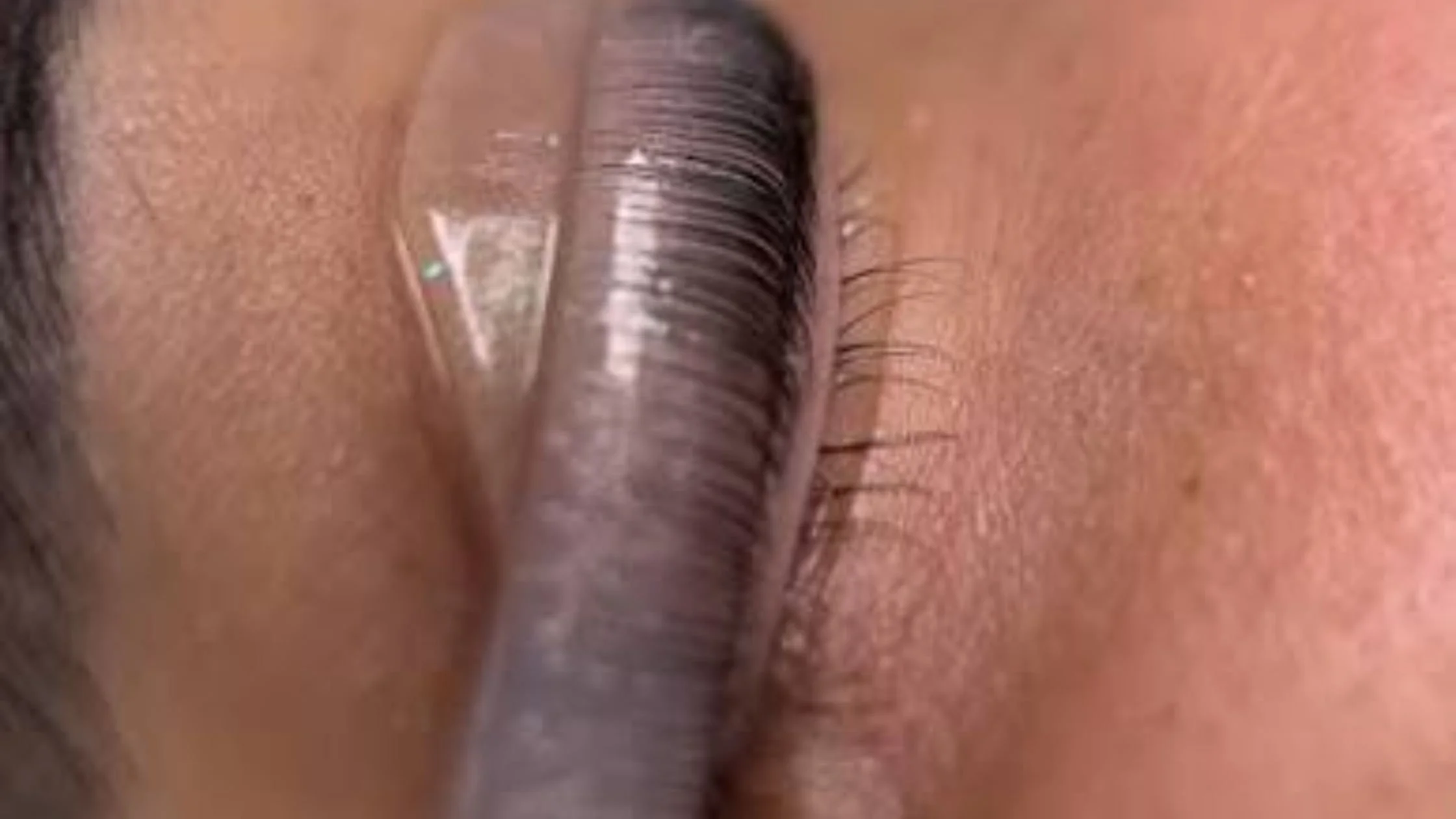 What happens during the appointment?