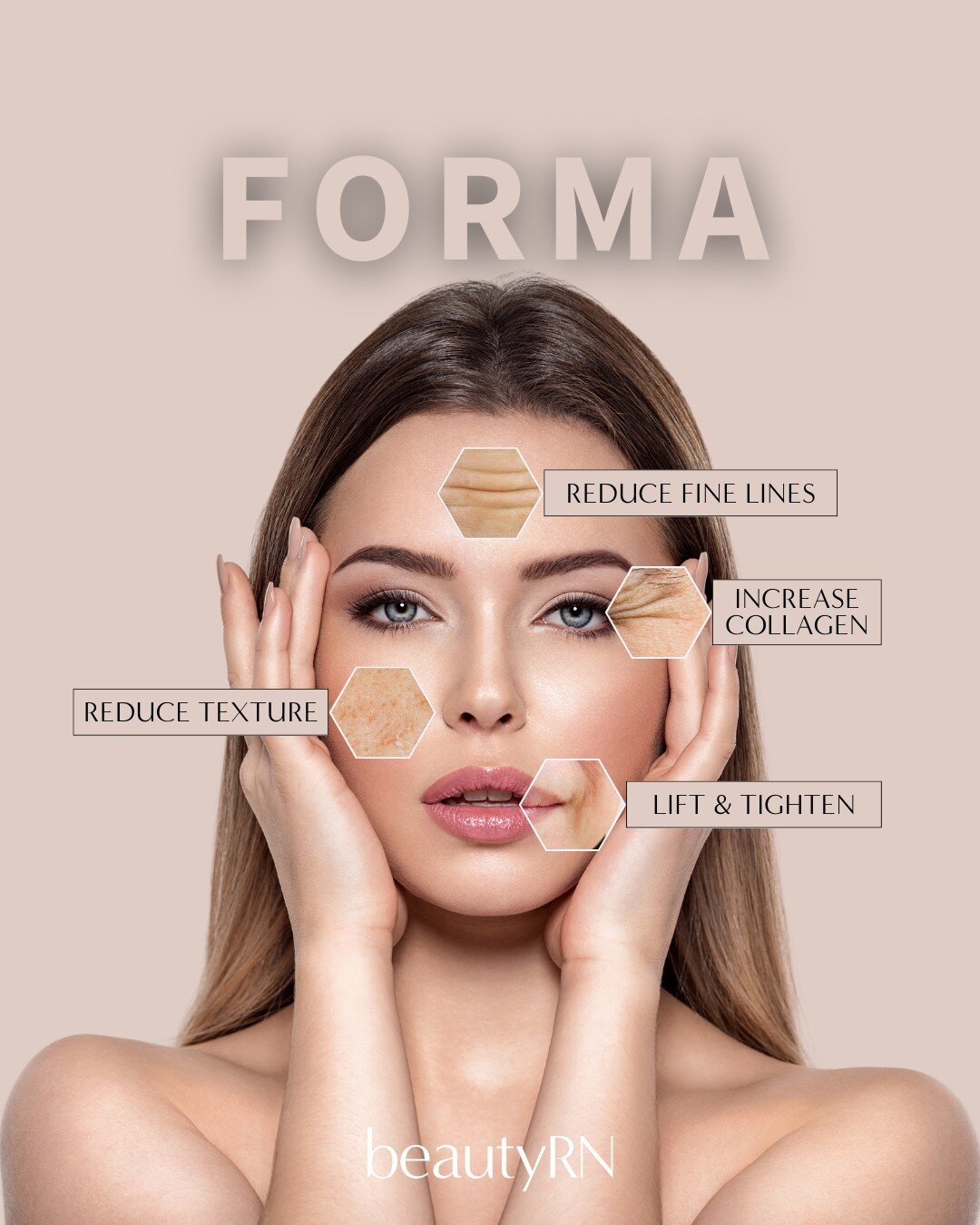 Say goodbye to invasive procedures and hello to the future of non-surgical beauty: Forma facials! 🌟

Experts call this treatment the &quot;non-surgical face lift,&quot; and for good reason. Forma is a non-invasive facial that works wonders on your s