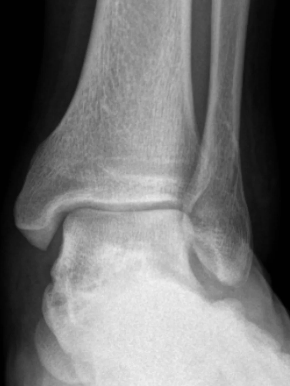 fractured foot playing soccer right in the middle of album pre pro week 🙏🏻
In all times GOD IS GOOD