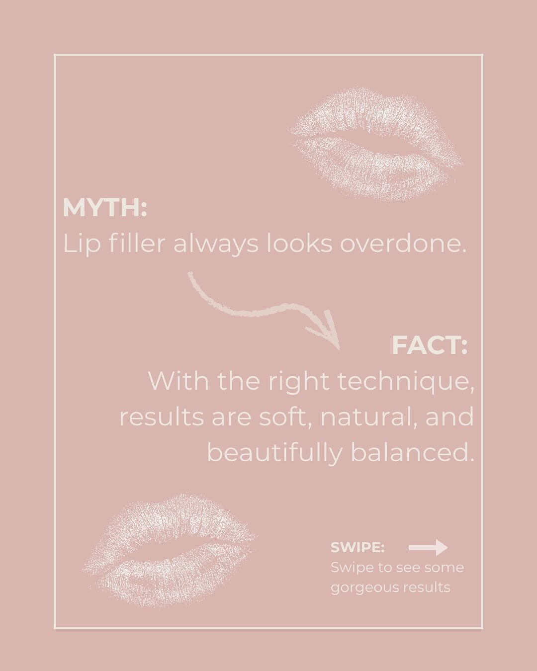 My approach is to customize every treatment to your desire and that often means we enhance your natural shape for a refreshed, youthful look. If you&rsquo;re curious what your lips would look like with a little filler November is the perfect time to 