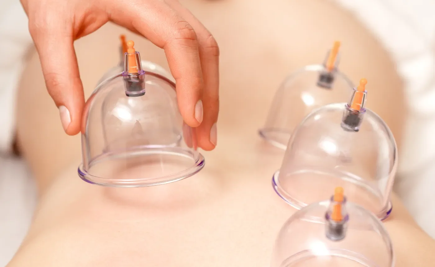 How Cupping Affects Circulation and Muscle Recovery