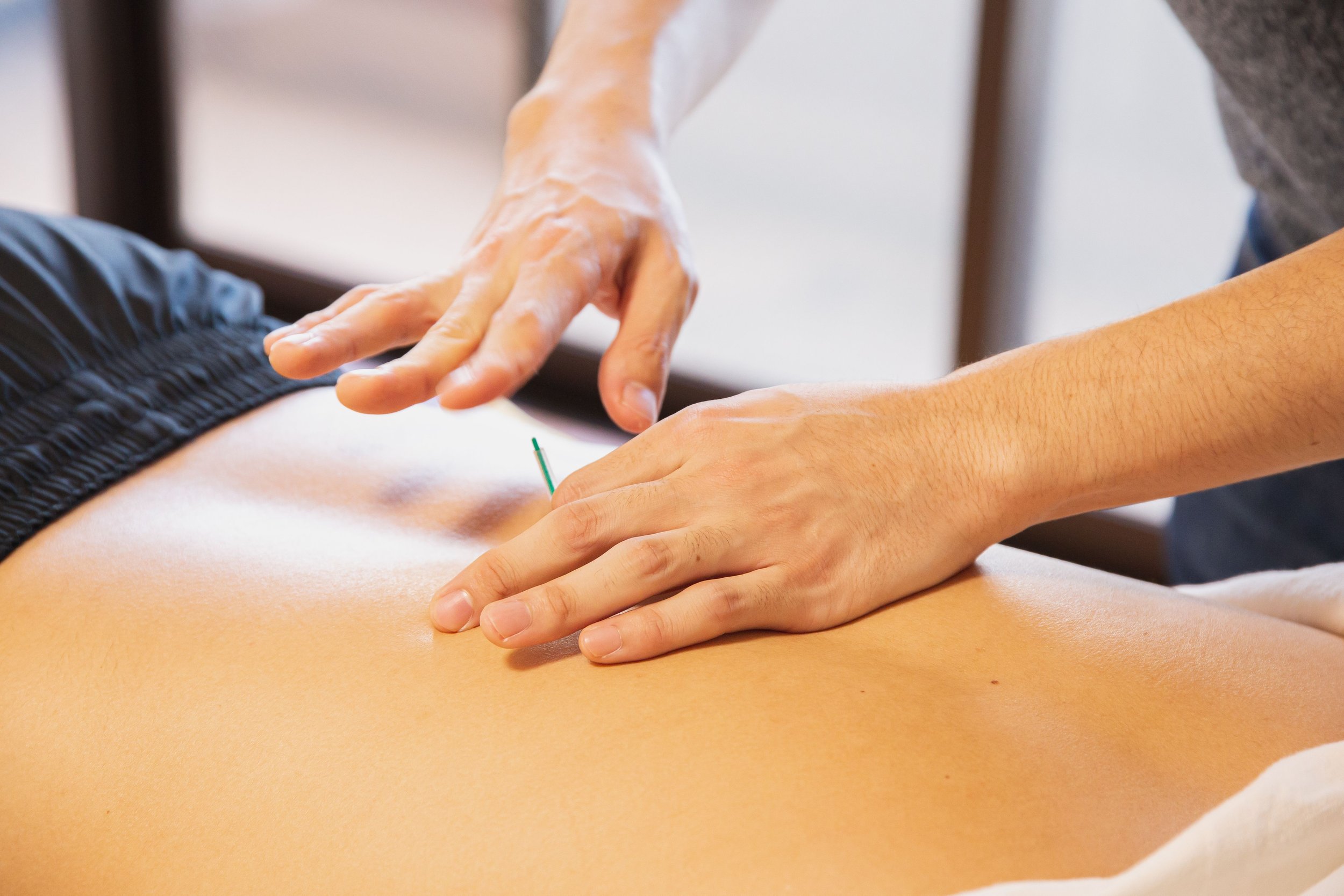 Acupuncture for lower back pain in Brooklyn: what the evidence says