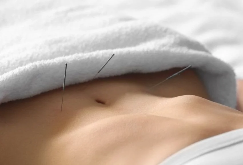 Acupuncture and Chinese medicine for gut health and bloating