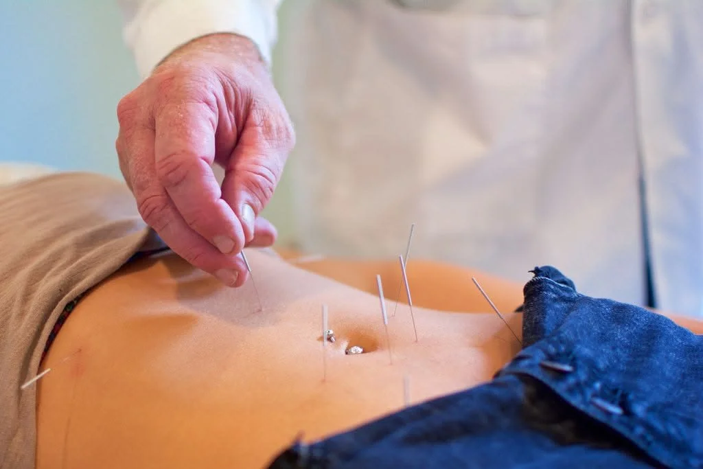 Acupuncture for PMS: Why Mood Swings, Bloating, and Cramps Are Connected