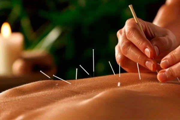 Sliding Scale Acupuncture in NYC: How It Works, and Who It's Really For