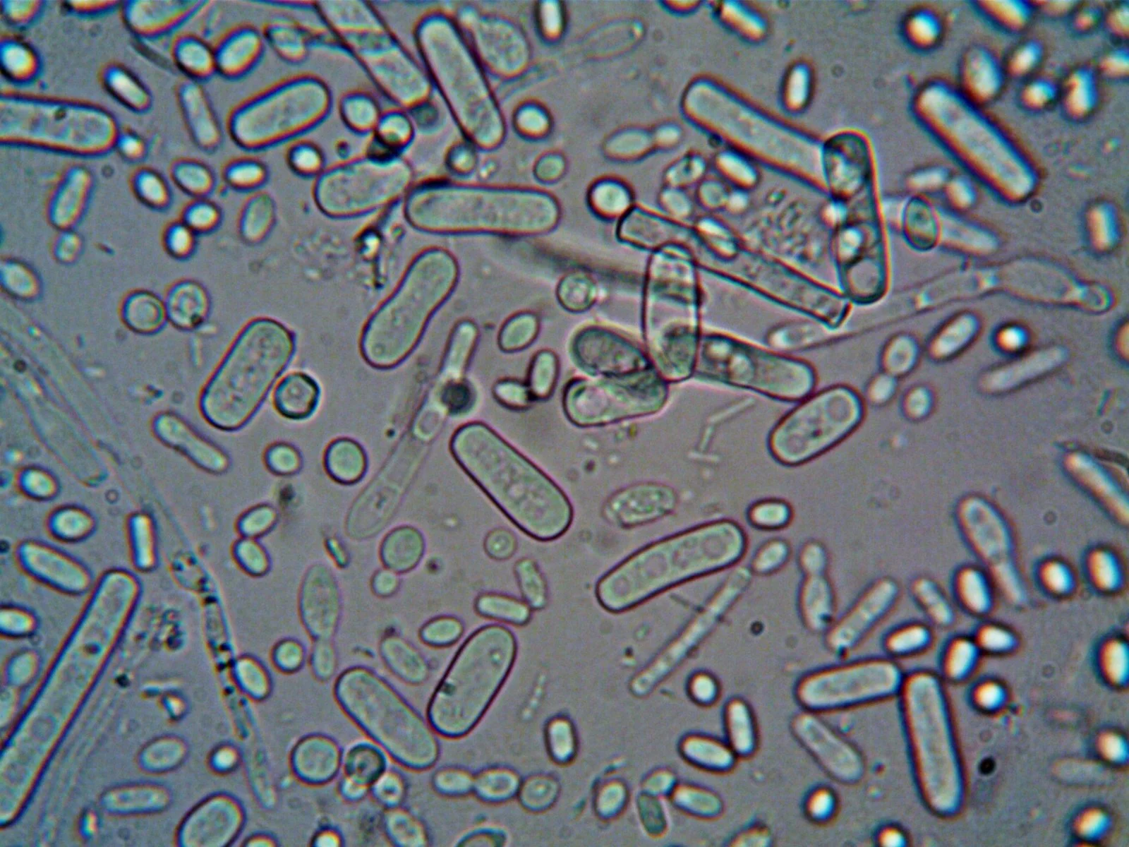 Bacteria and other microorganisms viewed under a microscope.