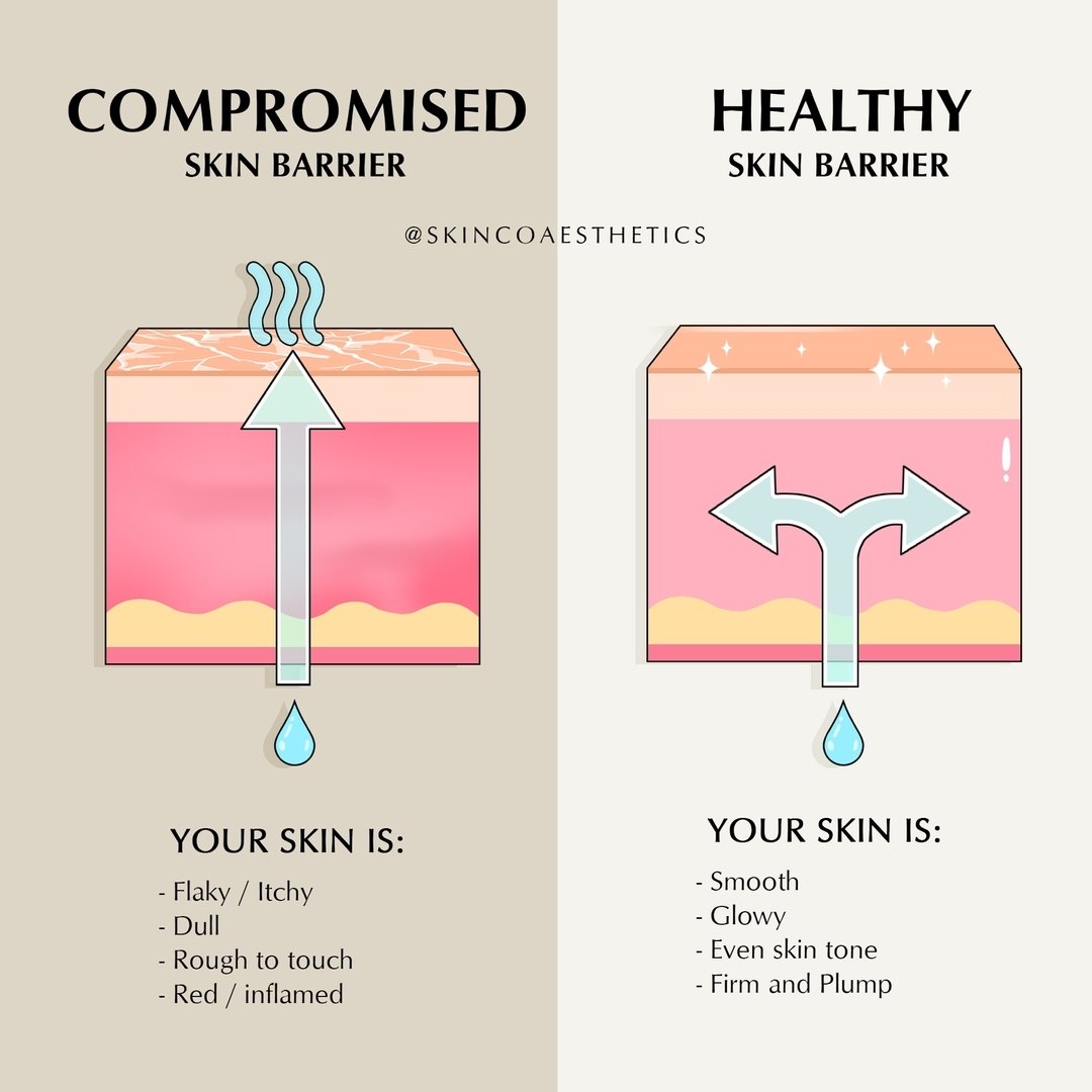 Your skin barrier is like a protective shield 🛡️ keeping moisture in &amp; harmful elements out. Understanding the difference between a compromised &amp; healthy skin barrier is crucial for maintaining skin health! 🫧

A healthy skin barrier is like