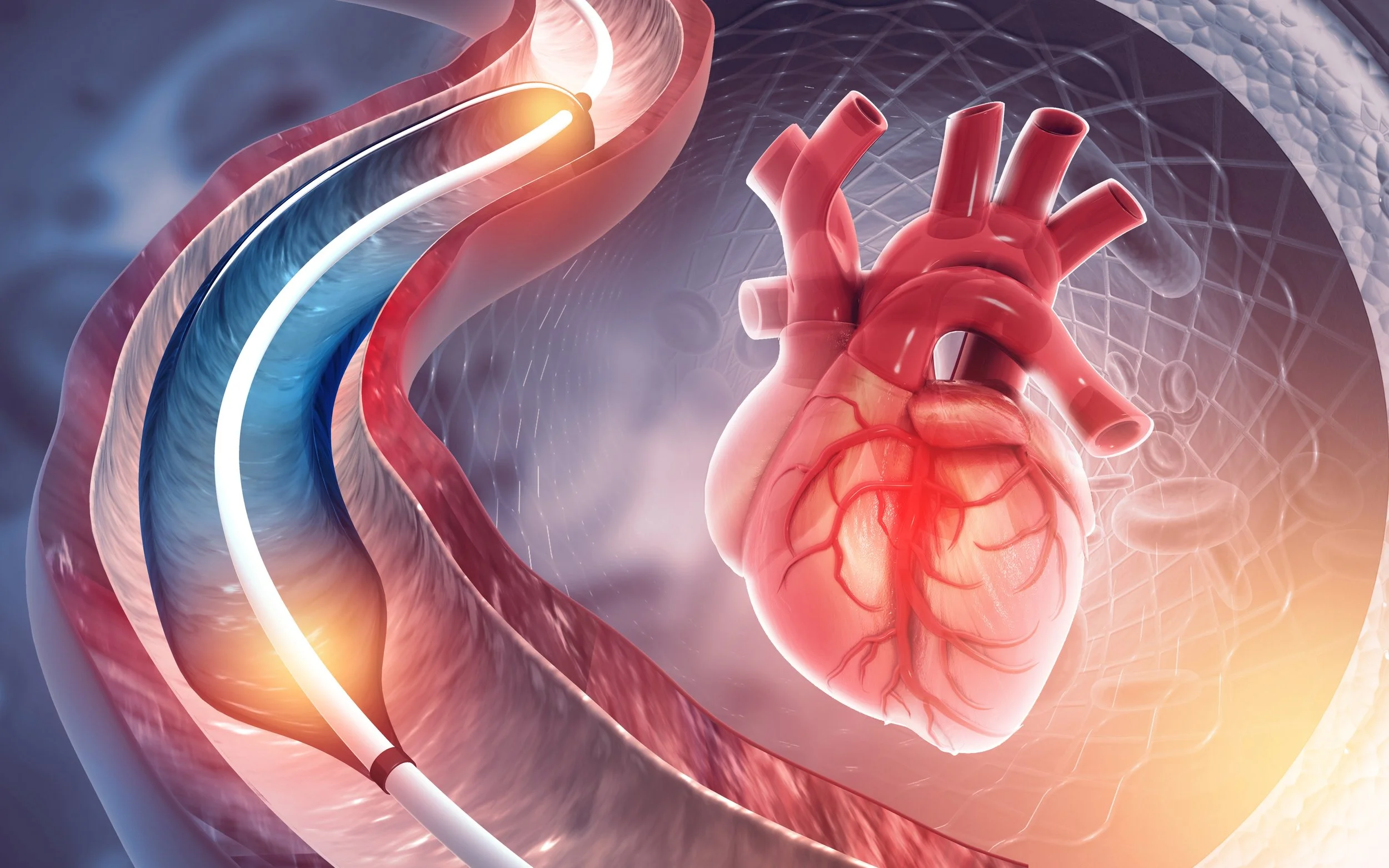 Coronary Balloon Angioplasty and Stenting