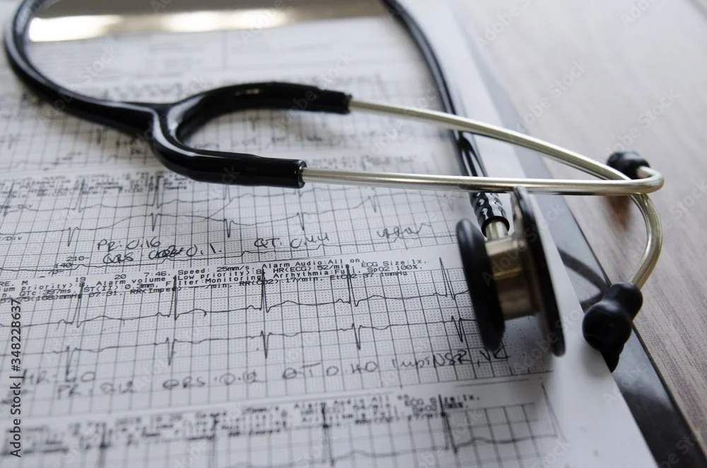 Loop Recorder Implant