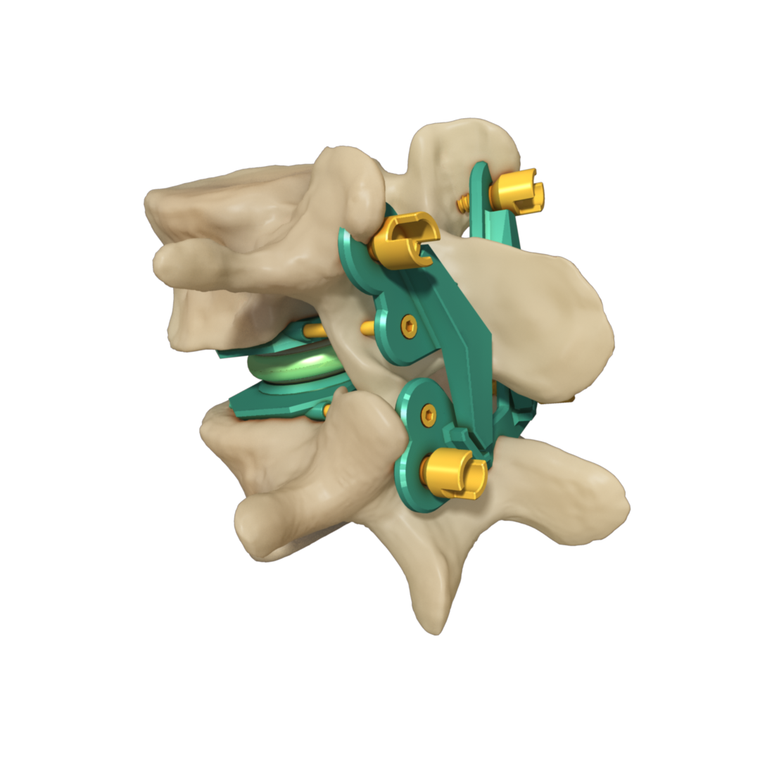 Implant.png