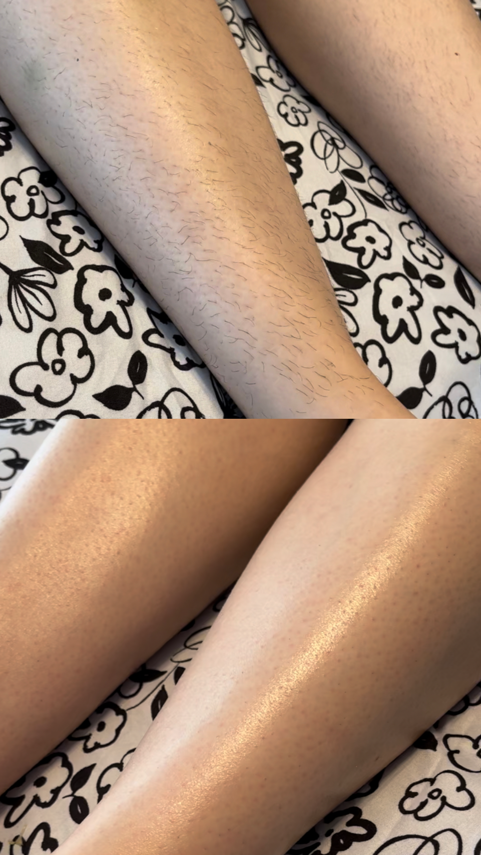 before-and-after-sugaring-hair-removal-results-all-that-beauty-bar-ottawa
