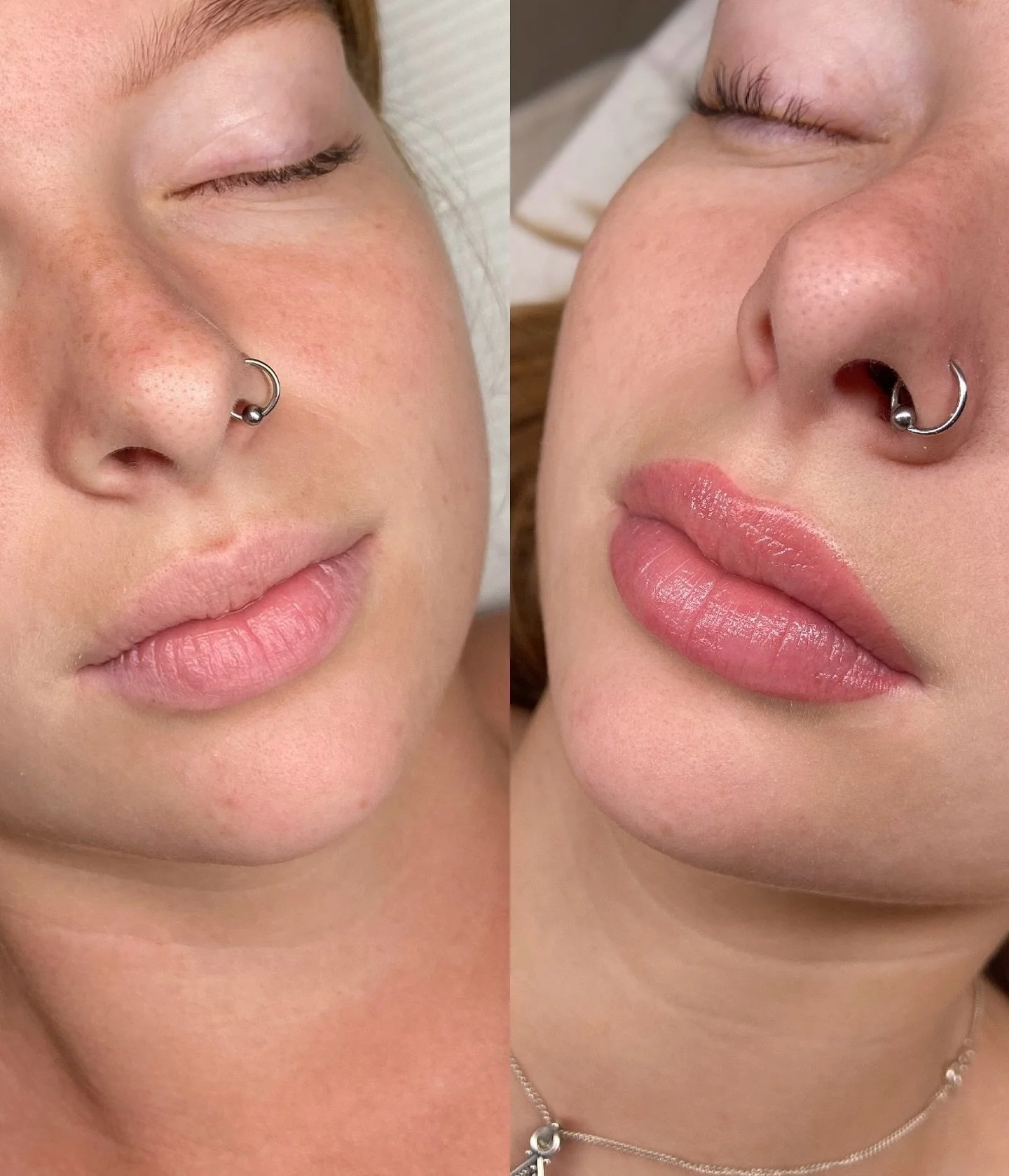 Before and after healed Lip Blush! 💋

Lip Blush is a semi-permanent treatment that enhances the natural colour and shape of your lips, giving them a fuller and more defined look.

It&rsquo;s the perfect solution for anyone wanting naturally beautifu