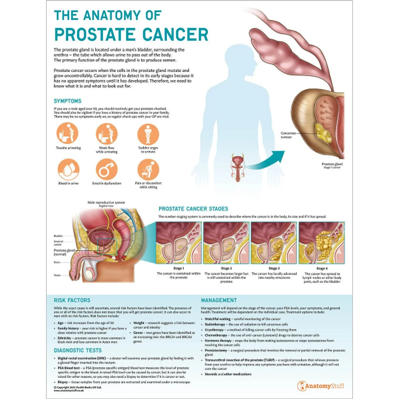 the-anatomy-of-prostate-cancer-poster-chart__80440.jpeg