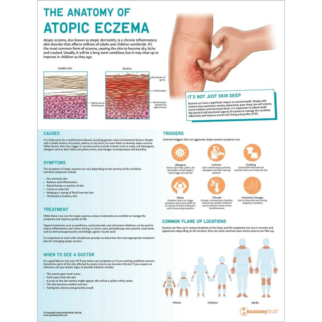 The_Anatomy_of_Atopic_Eczema_Poster_AnatomyStuff__51478.jpeg